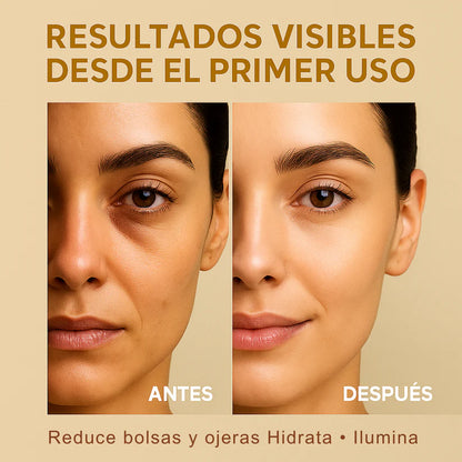 AuraEyes™ Tratamiento Para Ojos
